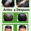 Shampoo Anticanas Dexe Negro3 Shampoo Anticanas Dexe Negro