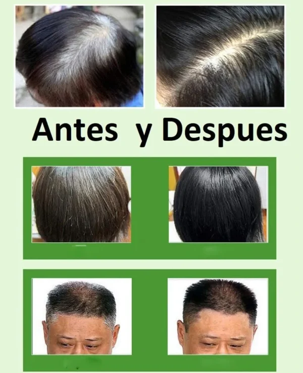 Shampoo Anticanas Dexe Negro3 Shampoo Anticanas Dexe Negro